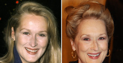Meryl Streep: Good Genes or Good Docs?