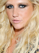 Ke$ha Glues Studs To Her Head!