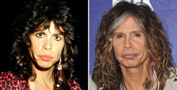 Steven Tyler: Good Genes or Good Docs?