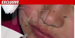 Botox Mom -- New Photos -- So Who's Lying Now?