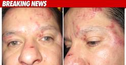 'NJ Housewives' Sued Over Bloody Attack on Cop