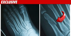 Ricky Romance: Man-Slapping Bouncer Broke My Foot!