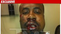 Cedric Benson's Alleged Beating Victim -- BLOODY Photo