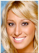 Vienna Girardi: See Her New Face, Post-Nose Job!
