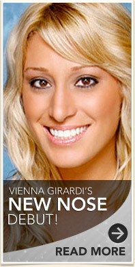 Vienna Girardi: See Her New Face, Post-Nose Job!