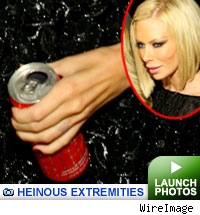 Heinous extremities gallery: Click to launch photos
