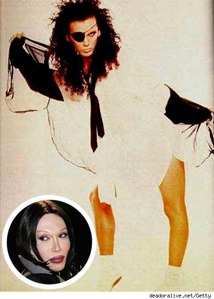 Pete Burns