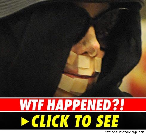 Michael Jackson's bandaged face -- see photos