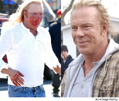 mickey rourke plastic surgery. Mickey Rourke