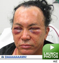 What the Hell Happened to Your Face? -- click to launch