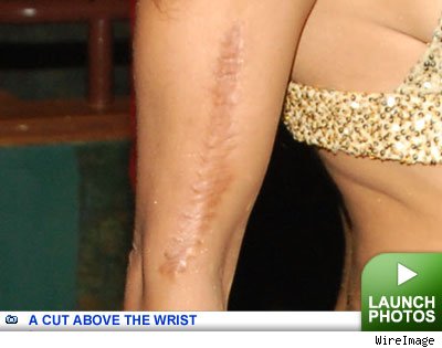Celeb Scar -- click to launch