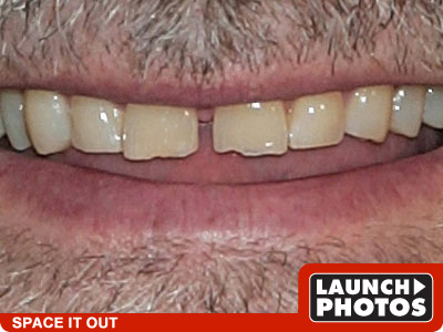 Gapped Teef - click to launch