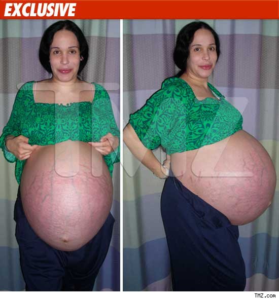 Bellies After Pregnancy. octomom pregnancy photo