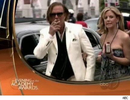 mickey rourke bad surgery