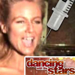 DWTS Scandal