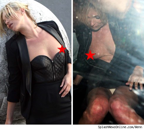 kate moss breast