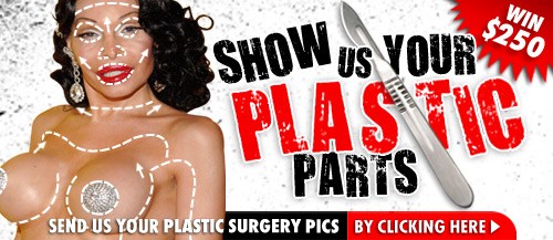 TMZ Send Us Your Plastic Parts