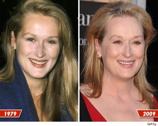 Meryl Streep: Good Genes or Good Docs?! Meryl Streep
