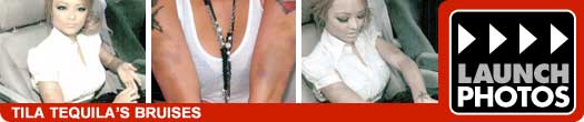 Tila Tequila Bruises