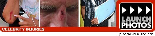 Celebrity Injuries