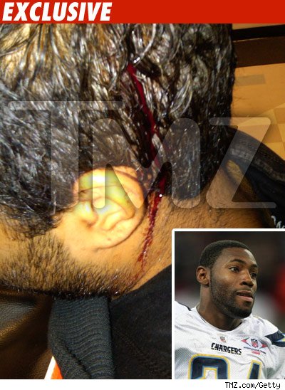NFL Star Investigation -- The Bloody Damage NFL Star Investigation -- The Bloody Damage