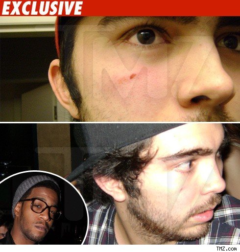 Kid Cudi's Alleged Victim -- No Hard Feelings Kid Cudi