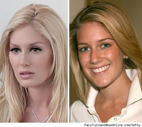 post op dating. Pre or Post-Op Heidi Montag: Who'd You Rather?