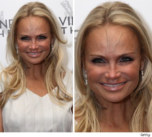 Kristin Chenoweth -- You're So Vein Kristin Chenoweth