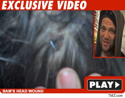 0615_margera_tmz_video_v2