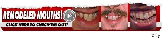 0628_teeth_300