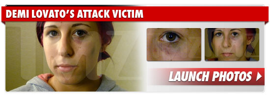 1223_demi_lovato_attack_victim_footer