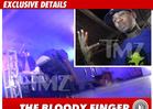 The Game -- Hospitalized After Bloody Guitar Smash