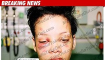 Brutal Rihanna Photos Surface 