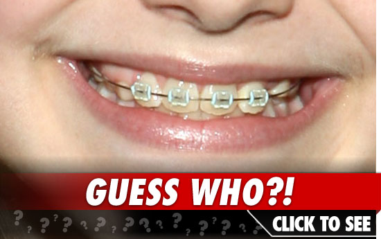 0426_welcome_braces_launch