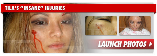 0606_tila_injuries_footer