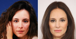 Madeleine Stowe: Good Genes or Good Docs?