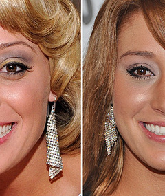 Vienna Girardi Hits Red Carpet with New Nose