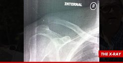 Drew Carey -- BUSTS Collarbone, 'Price is Right' Postponed