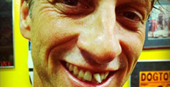 Tony Hawk -- Oops, I Broke My Face! 