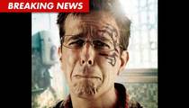 Ed Helms' Stunt Double Sues -- Claims 'Hangover' Accident Caused Brain Injuries