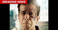 Ed Helms' Stunt Double Sues -- Claims 'Hangover' Accident Caused Brain Injuries