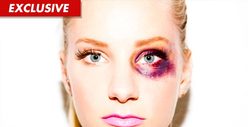 'Glee' Star -- Bruising Photo to Help Domestic Violence Victims