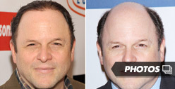 Jason Alexander -- The Magical Hair Growth