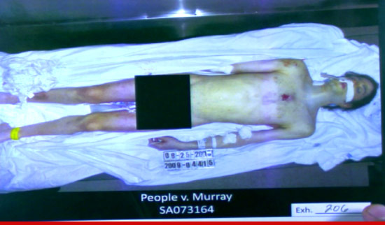 Michael Jackson Autopsy Photo