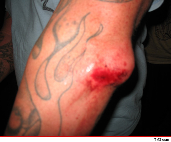 1021_gruesome_injury_SUB