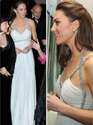 Duchess Kate's Mysterious Scar -- Where Did It Come From?
