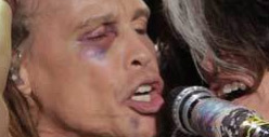 Steven Tyler Performs -- Black Eye, White Teeth