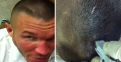 WWE Star Randy Orton -- GAPING Head Wound Stapled Shut ... On Tape!!!