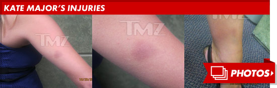 1116_kate_major_injuries_footer