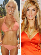 Stars Who've Admitted to Plastic Surgery